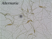 Alternaria