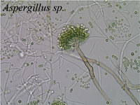 Aspergillus