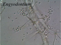 Engyodontium